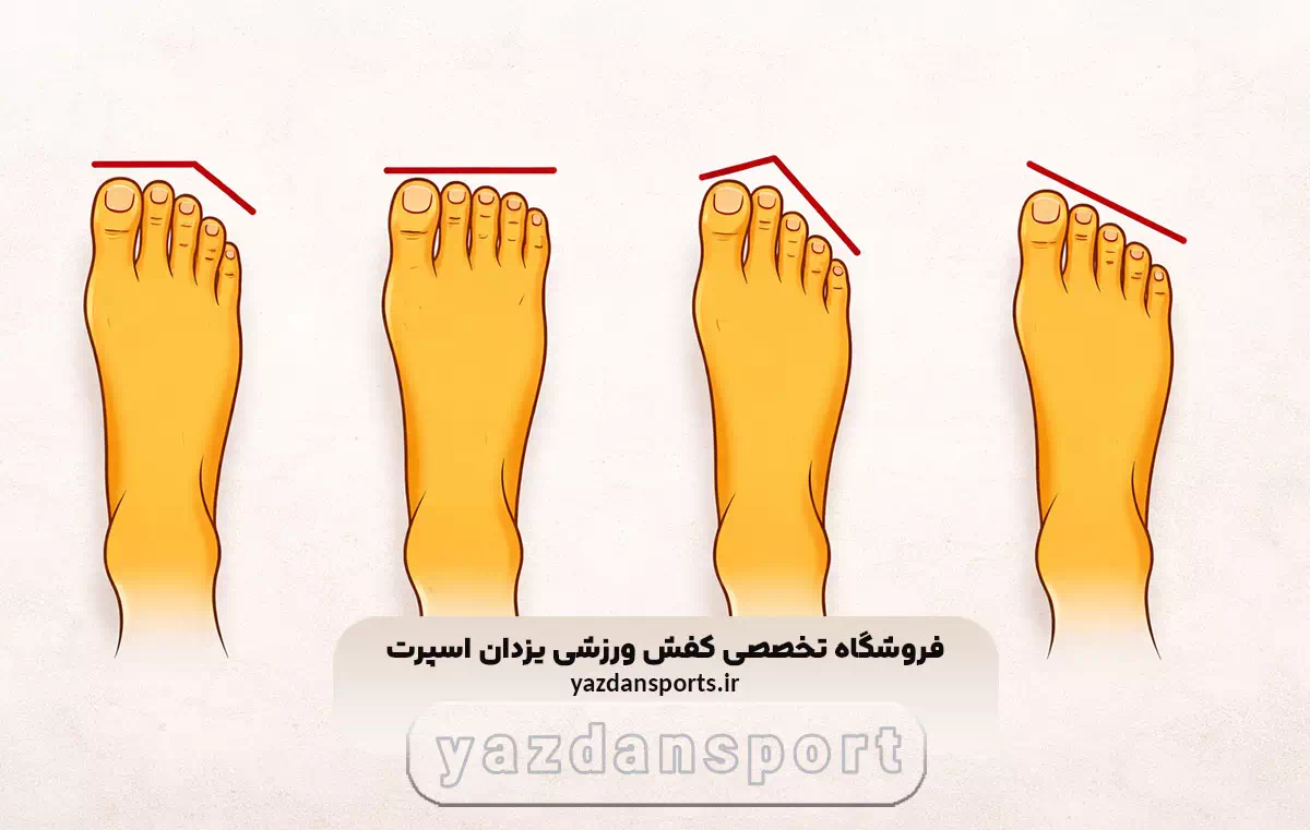 انواع شکل فیزیکی پای انسان و اهمیت انتخاب کفش مناسب (2)